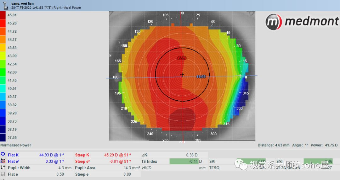 视光冷知识|OK镜的荧光评估靠谱吗？
