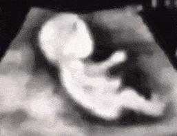 怀孕后吃得太多对胎儿有影响吗,怀孕吃得少会影响胎儿发育