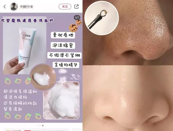 专治螨虫的洗面奶,螨虫专用洁面乳