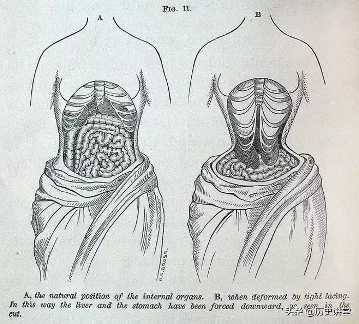 历史上那些审美陋习,古代病态审美束腰裹脚