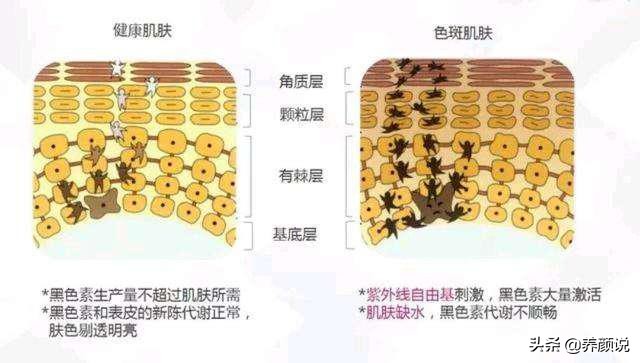 护肤品越用越多,肌肤状态急剧下滑,护肤品真的有效?