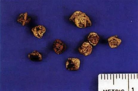 猫咪尿结石的症状有哪些,猫咪尿结石可以喂肾石通颗粒