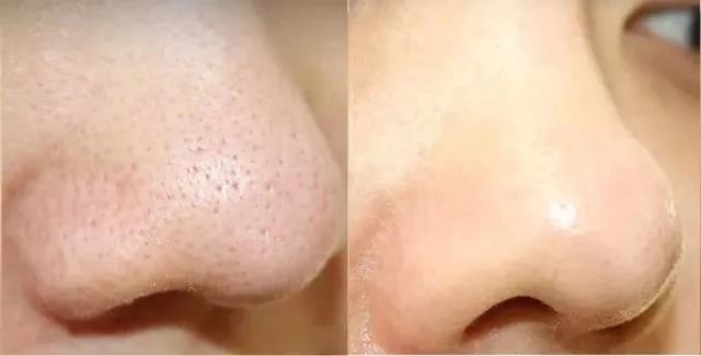 takami美容液效果怎么样,takami黑头水