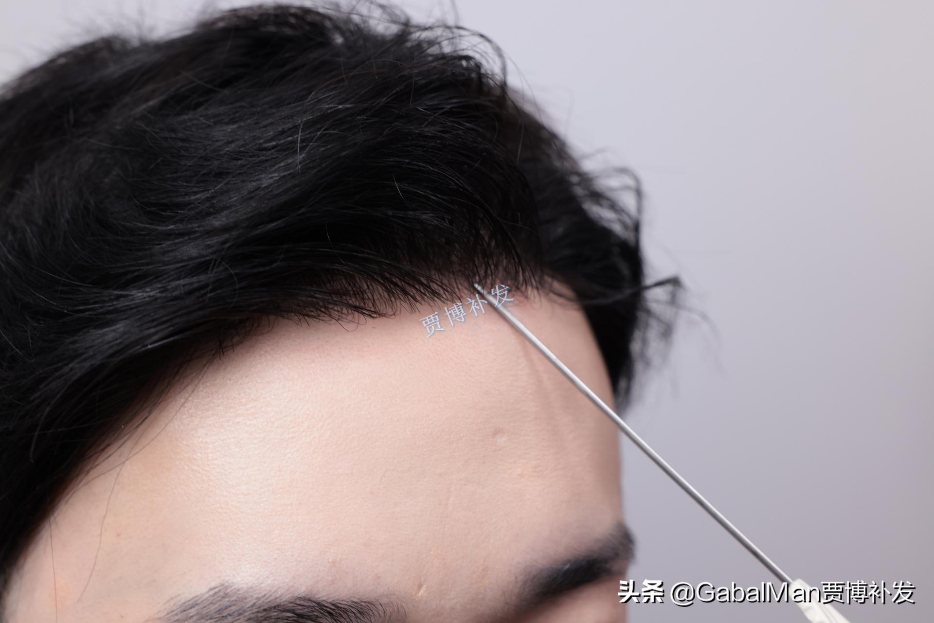 不怕风吹雨淋的假发,不怕风的假发