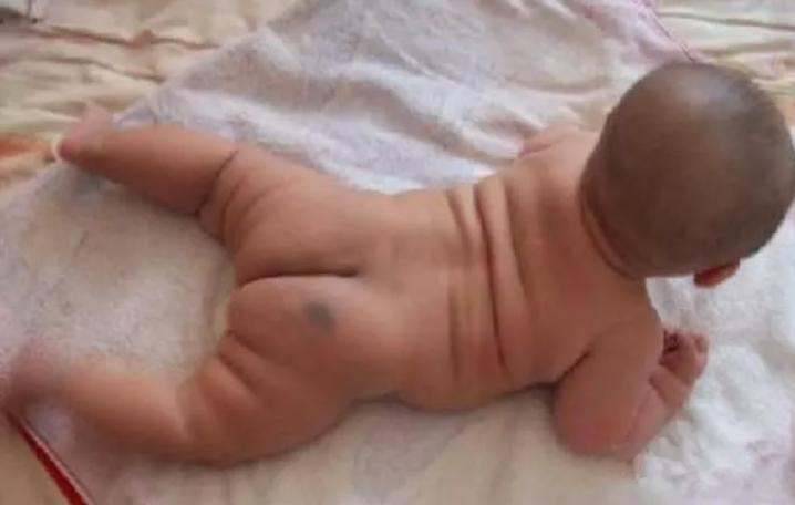 刚出生的宝宝特殊现象,刚出生宝宝吓住了怎么办