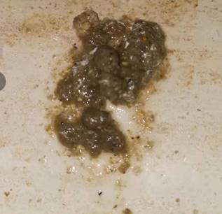 肉鸡肠道不好长期拉稀的原因,肉鸡后期拉稀是什么原因