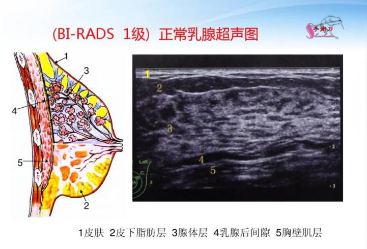 乳腺bi-rads分类有哪些,乳腺bi-rads的分类