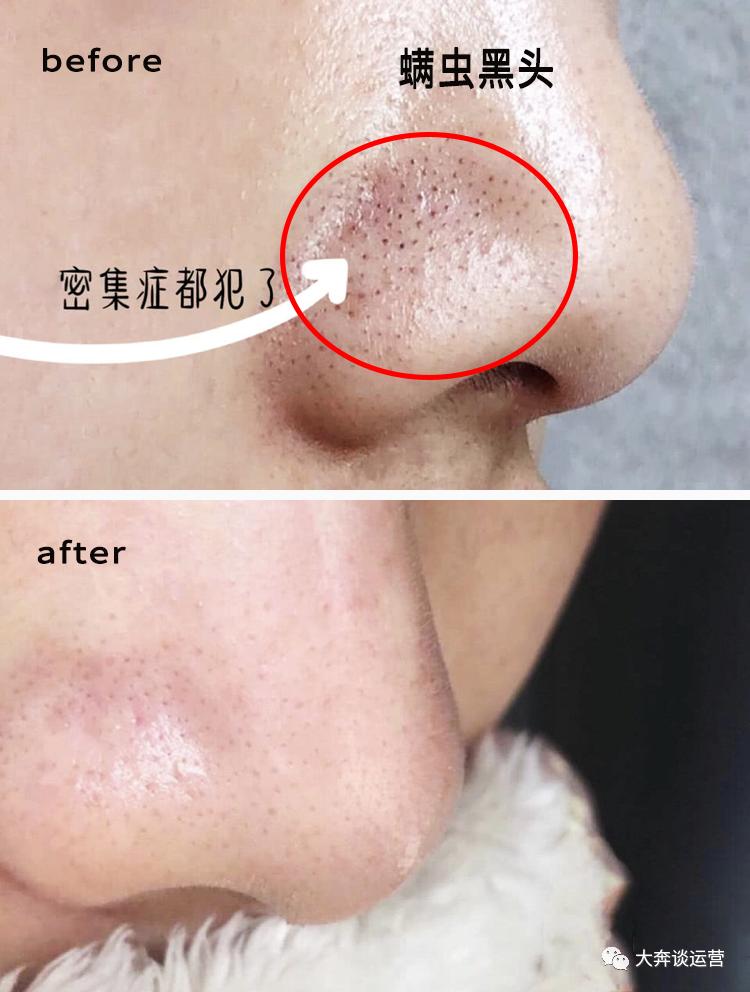 大牌洗面奶哪款好用排行榜最新版,洗面奶到底哪款好用又实惠