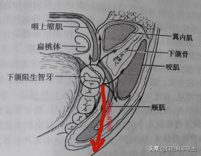 不要让牙齿毁了你的五官,别让一颗牙毁一口牙