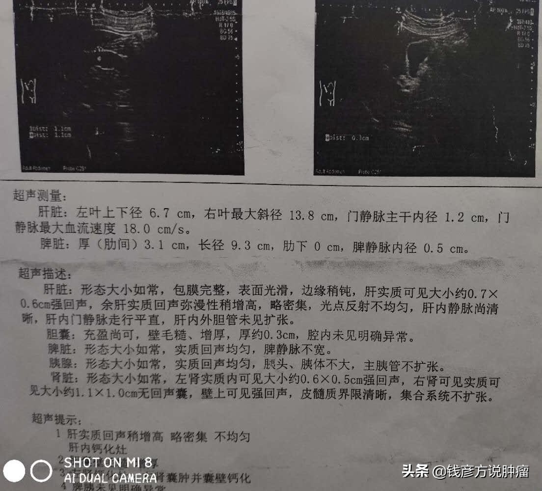 胃息肉和胆囊息肉中医的治疗方法,胃肠息肉手术后怎样调理不会复发