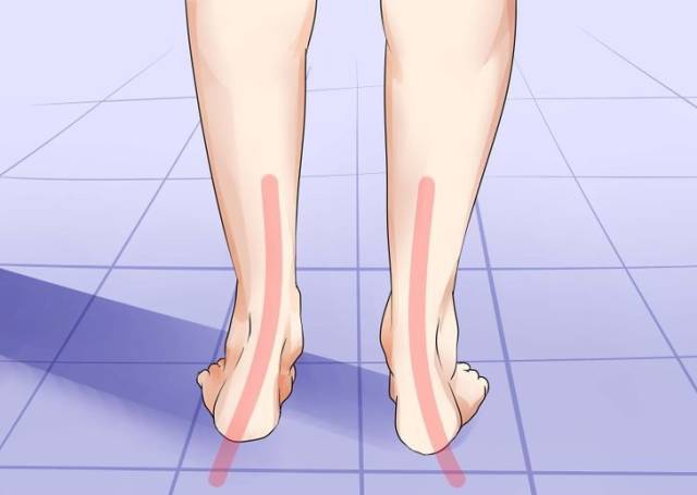 外八字脚会不会影响膝盖,跑步时八字脚产生原因及纠正方法