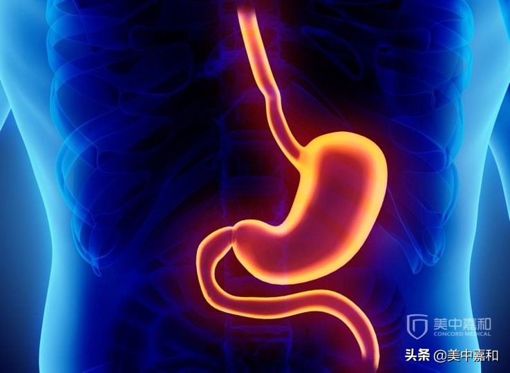 有治疗胃癌的黑科技吗,有没有治疗胃癌好的机器