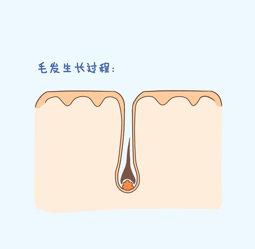 头发变细油腻脱发怎么回事,头发变黄变细脱发是什么原因