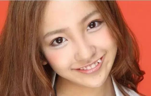 为什么人会长牙,为什么会有人长兔牙