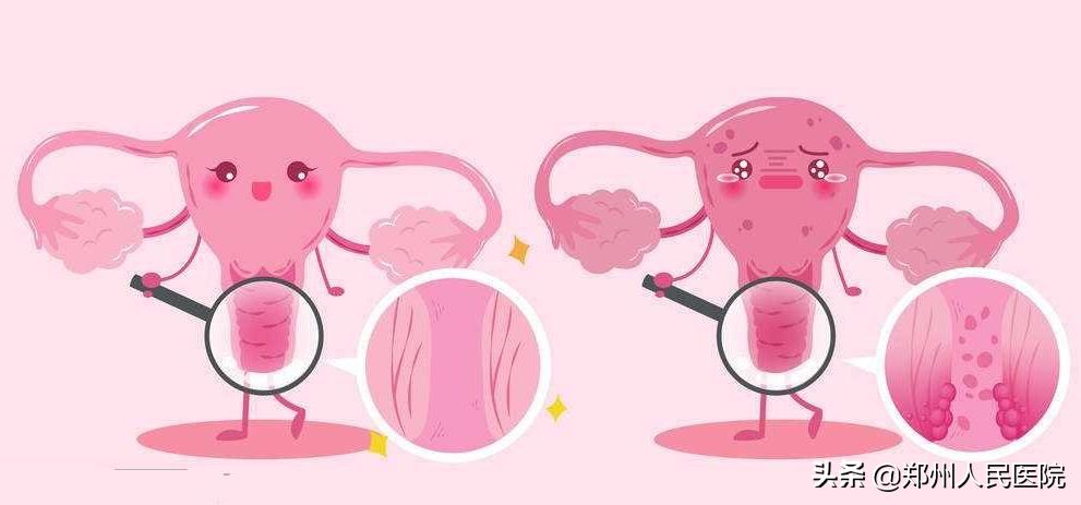 一次普通的检查却发现了重病,一次普通的检查竟是癌症