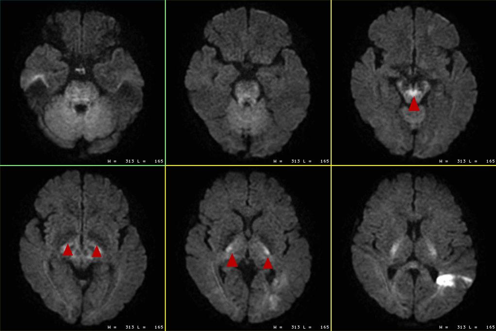 mri知识,mri讲解科普