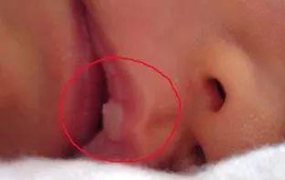 宝宝出生后的常见的一些问题