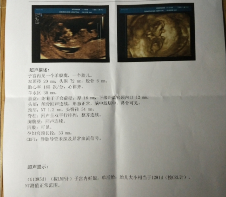 19岁的妹妹未婚先孕了,19岁意外怀孕未婚如何和家人说