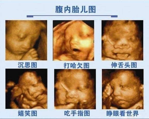 孕妈妈什么时候需要做心电图,四维彩超前注意事项