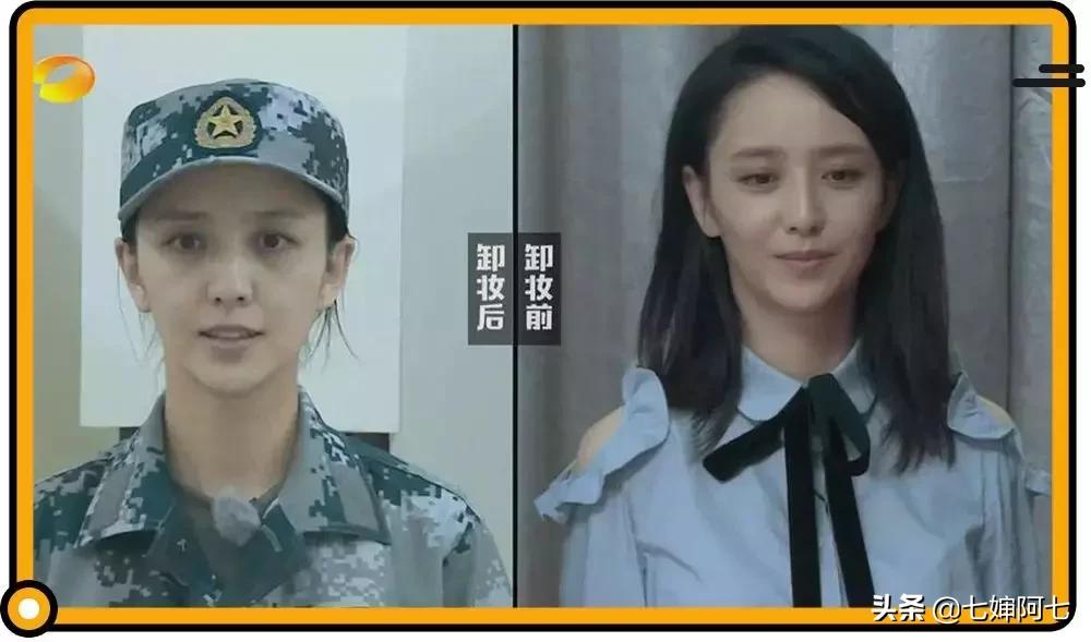 长久都无法消除的黑眼圈,顽固性的黑眼圈要怎么去