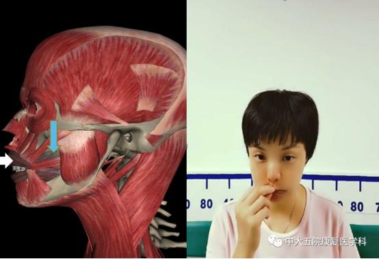 面瘫临床表现的科普视频,科普面瘫多久治疗效果最好