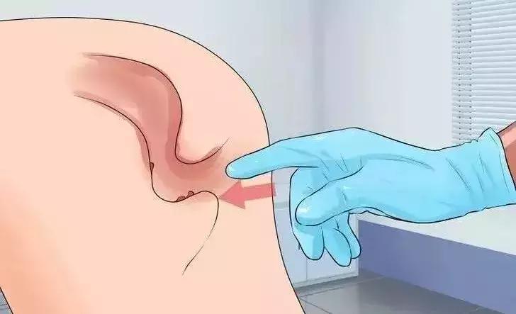 体检到底该查什么？不注意以下事项，小心让大病在眼皮底下溜走！