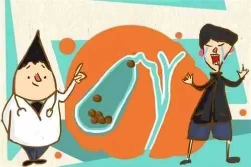 200以上排石药,排石药多少钱