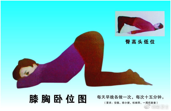 保巢口诀——天下女性的福音