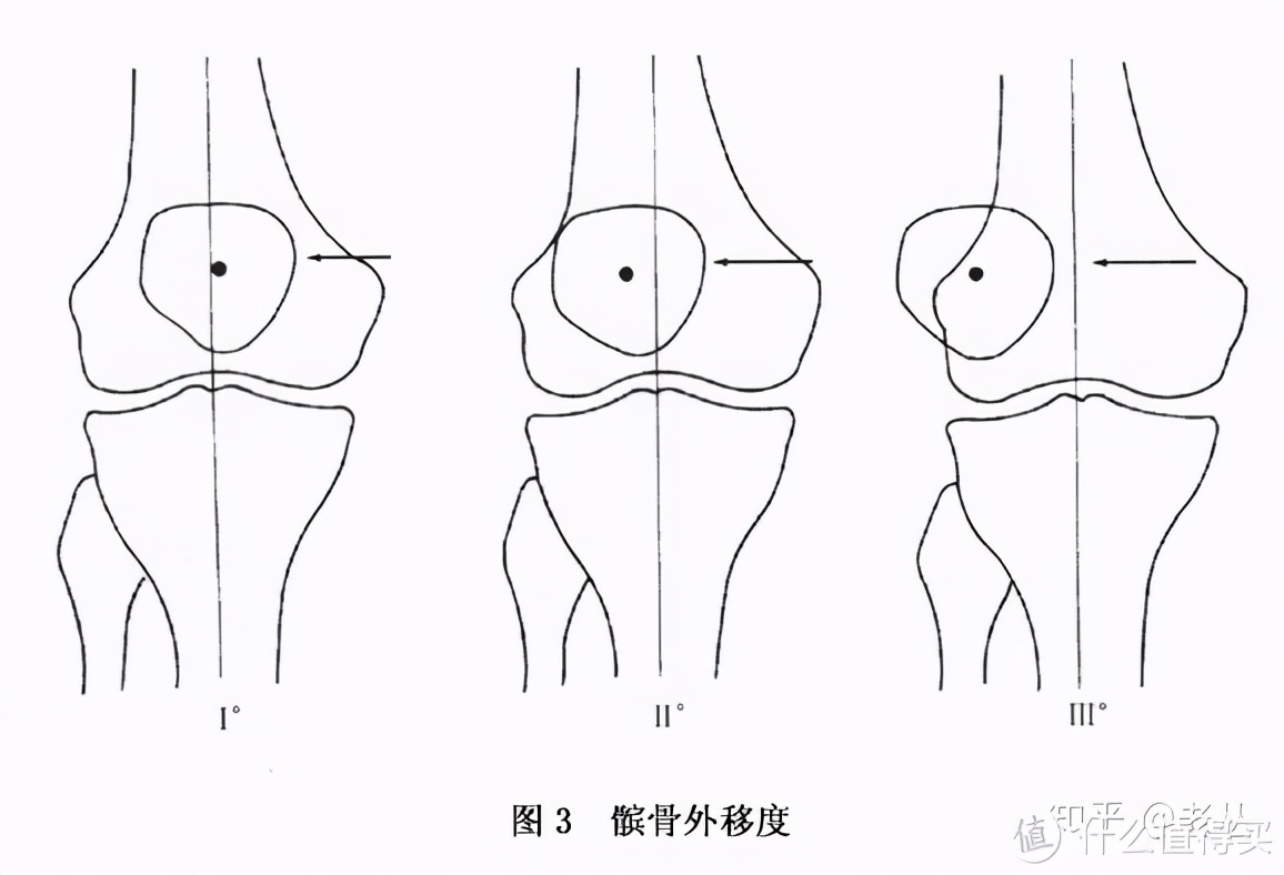 深蹲的好处和坏处深蹲的正确姿势,深蹲的标准动作与功效