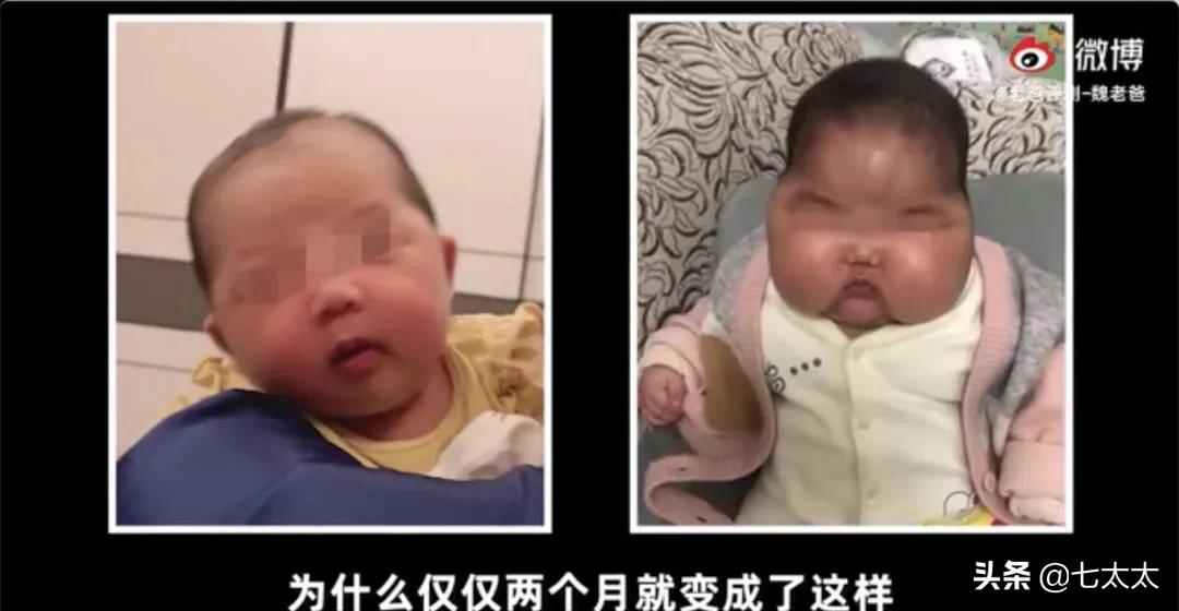 以「湿疹」之名的智商税,除了「大头娃娃」还有什么?