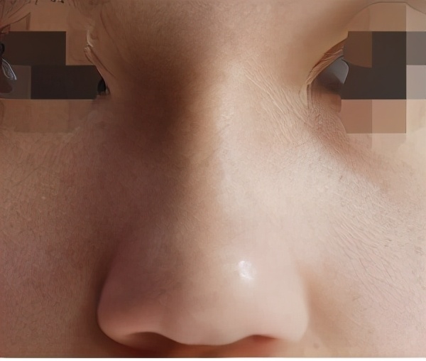 美之峰丁翔最新消息,长沙市美之峰医疗整形