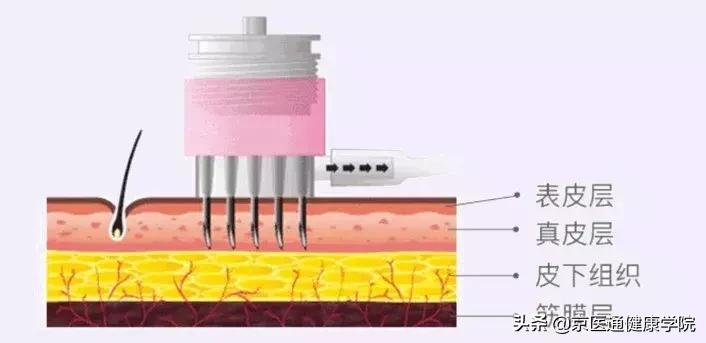 被吹上天的六种保健品实则坑钱,被吹上天的保健品有用吗