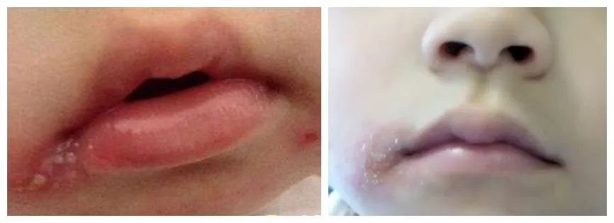 滋润保湿告别干燥起皮,保湿提亮肤色改善起皮防干裂