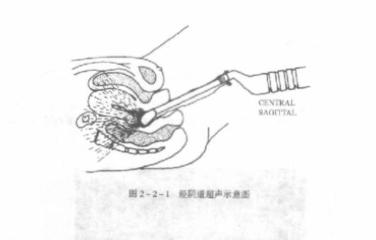 男生做过妇科检查吗,男性禁入