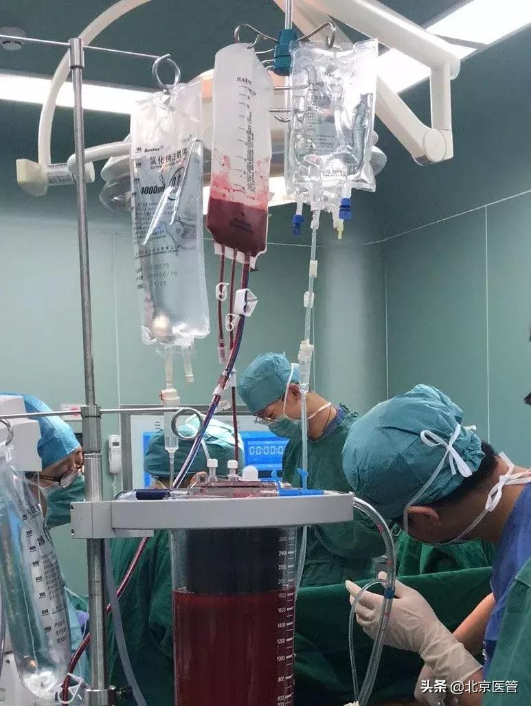 宫外孕大出血抢救无效死亡,成功救治宫外孕大出血休克