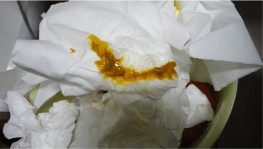 小奶猫怎么喂养才能养好,小奶猫怎么人工喂养视频