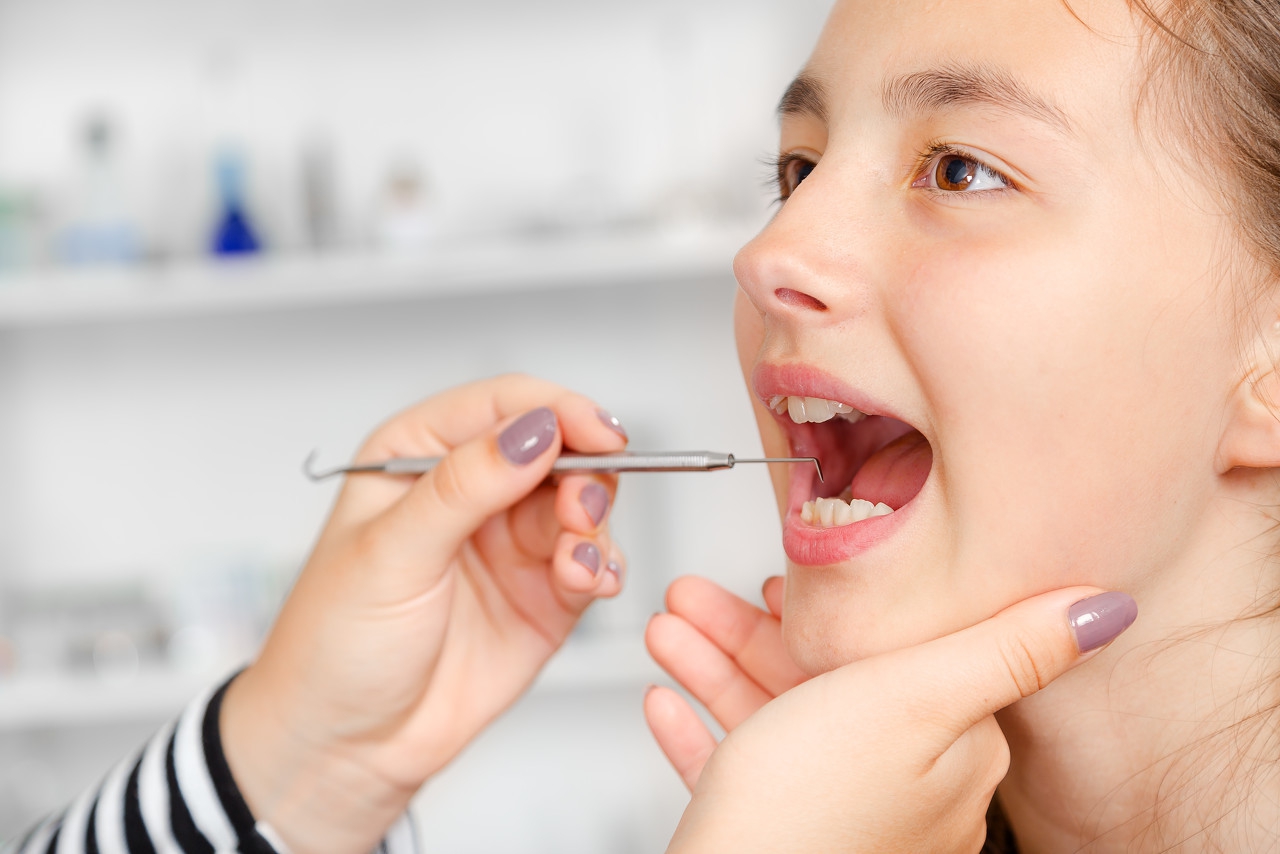 宝宝蛀牙的正确治疗方法,宝宝蛀牙有什么小偏方