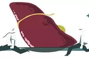 比乙肝厉害的肝病是什么,甲肝和乙肝丙肝的区别哪个危害大