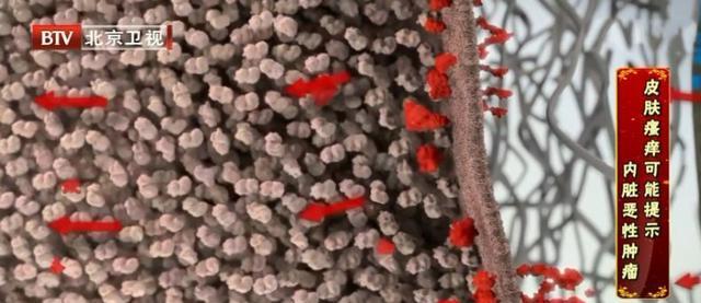 全身痒是糖尿病还是肝脏问题,皮肤瘙痒和血糖有关系吗