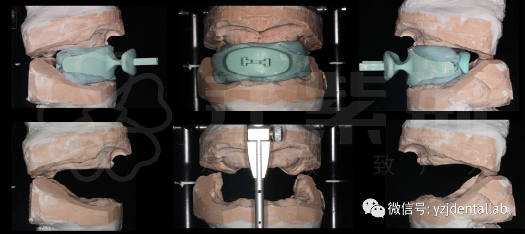 病例教学视频,病例分析操作技能