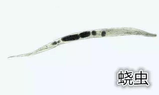 宝宝喜欢挠屁股,宝宝总是挠屁股是有虫子吗