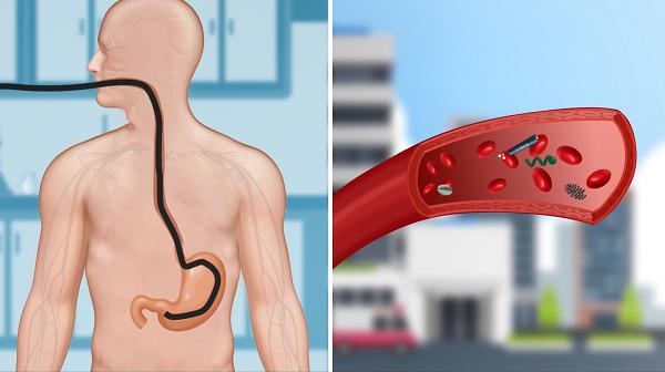 微型机器人和传统机器人结合实现体内狭小腔道的快速高精度递送