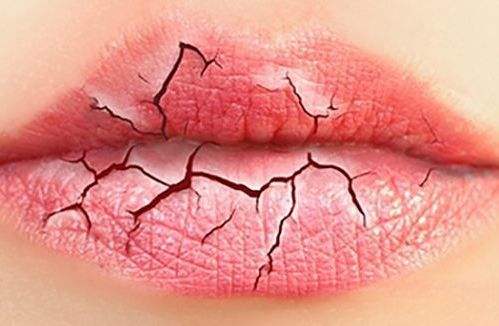 干燥的秋季如何拯救干裂的嘟嘟唇,精致女人保养的方法