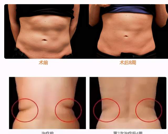 躺着就能瘦竟然是真的,躺着真的能瘦绝不是谬论