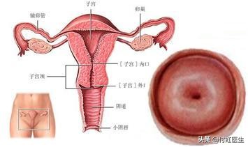 辟谣：房事过度宫颈肥大？