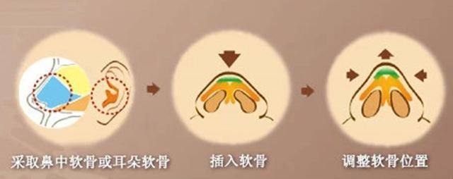 关节炎前期的症状和治疗方法,关节炎基础与临床