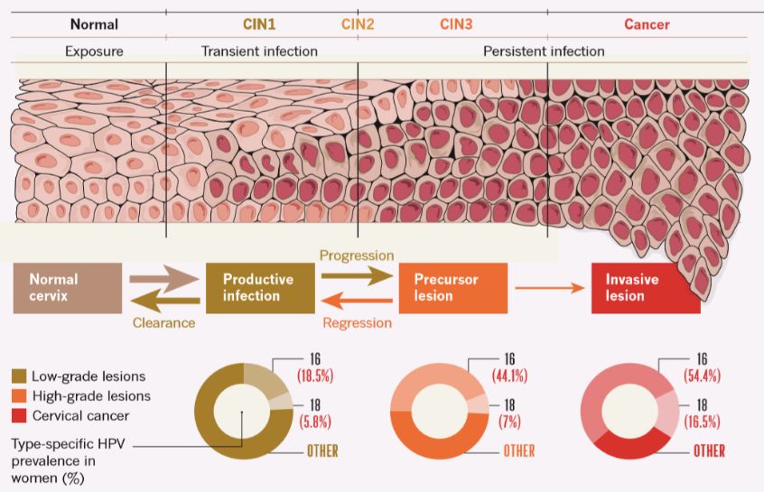 宫颈癌双筛的报告解读,宫颈癌最深度解读