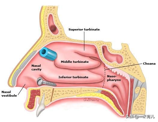 5岁鼻异物,18岁仍作妖!儿童发生鼻腔异物,先来做好这4步