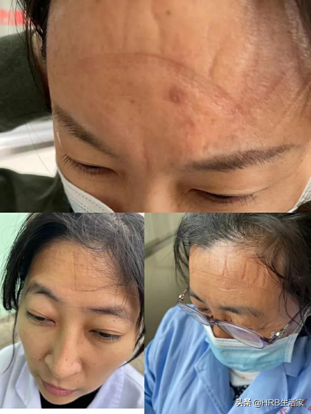 月圆日疫情来袭同战疫只争朝夕最美的“大白”——记哈市道外区人民医院大兴、南直社区核酸检测入户采样团队