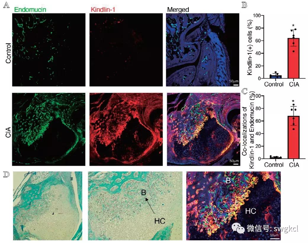 粘着斑相关蛋白Kindlin-1在血管内皮细胞的表达及功能研究